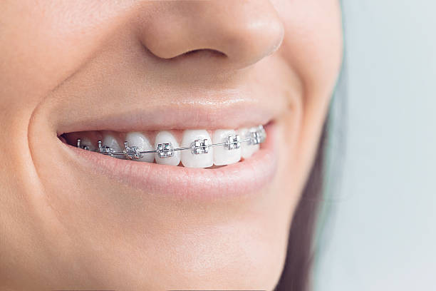 Best Invisalign and Clear Aligners  in Cornelius, NC